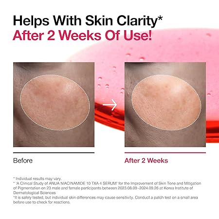 Anua Niacinamide 10% + TXA 4% Serum