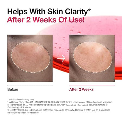 Anua Niacinamide 10% + TXA 4% Serum