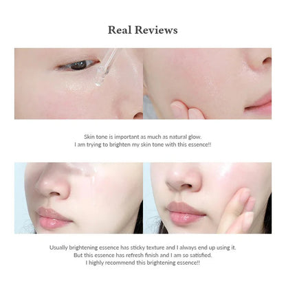 Dr. Althea Natural Radiance Essence 30ml | 85% Vitamin C Brightening Serum