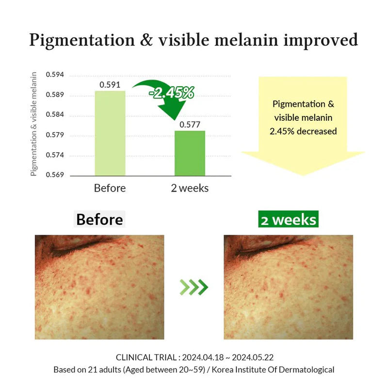 Dr. Althea Gentle Vitamin C Serum 30ml | 20% Sea Buckthorn Brightening & Anti-Aging Serum